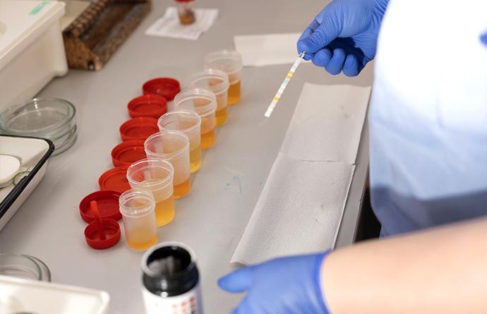 these low-cost, reliable pipette pumps are used primarily in 5 settings clinical diagnostics